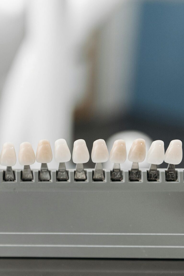 Faccette dentali a Napoli