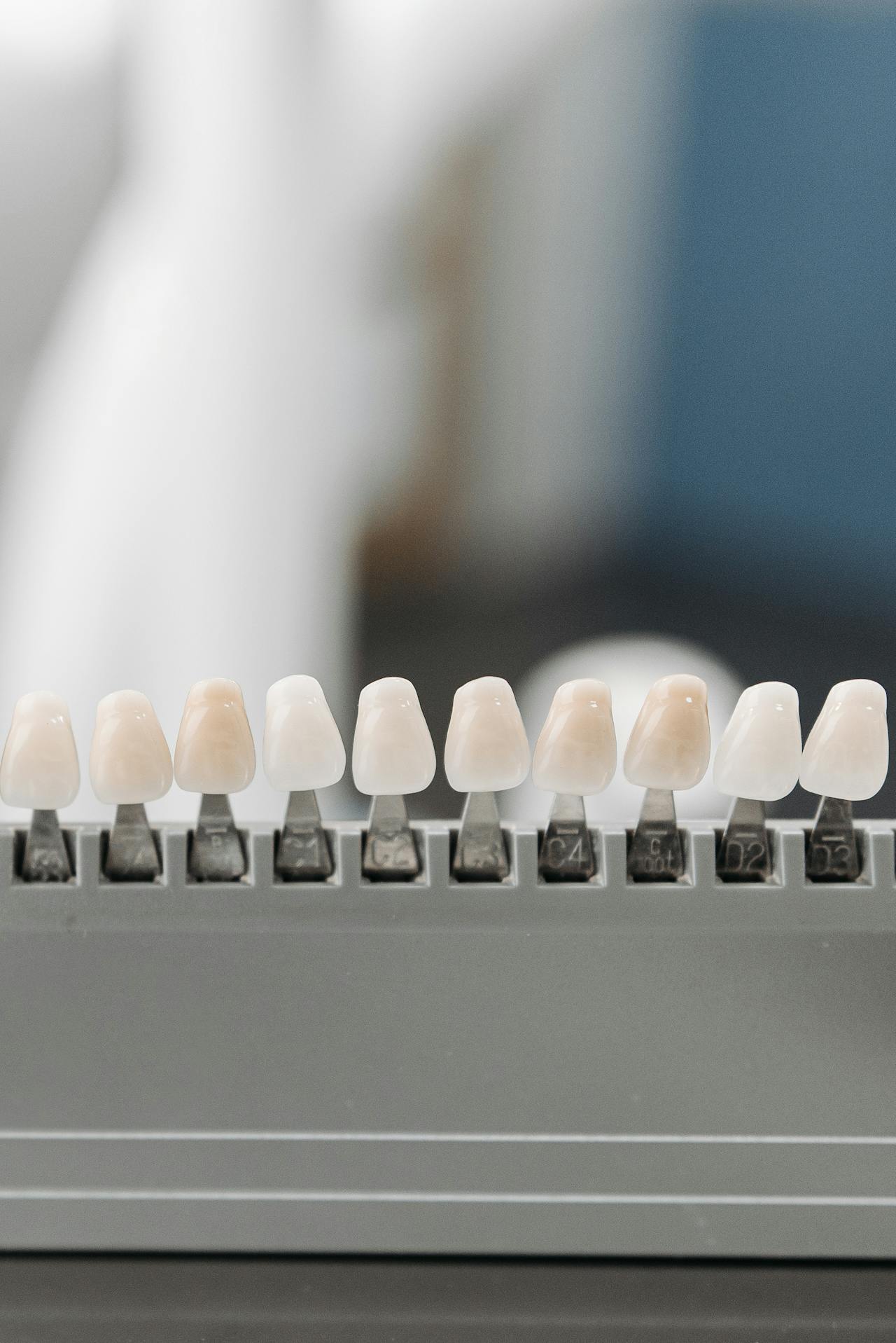 faccette dentali a Napoli