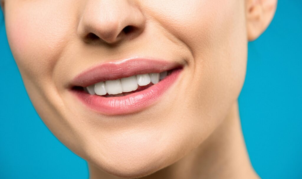 Faccette dentali a Napoli e Roma